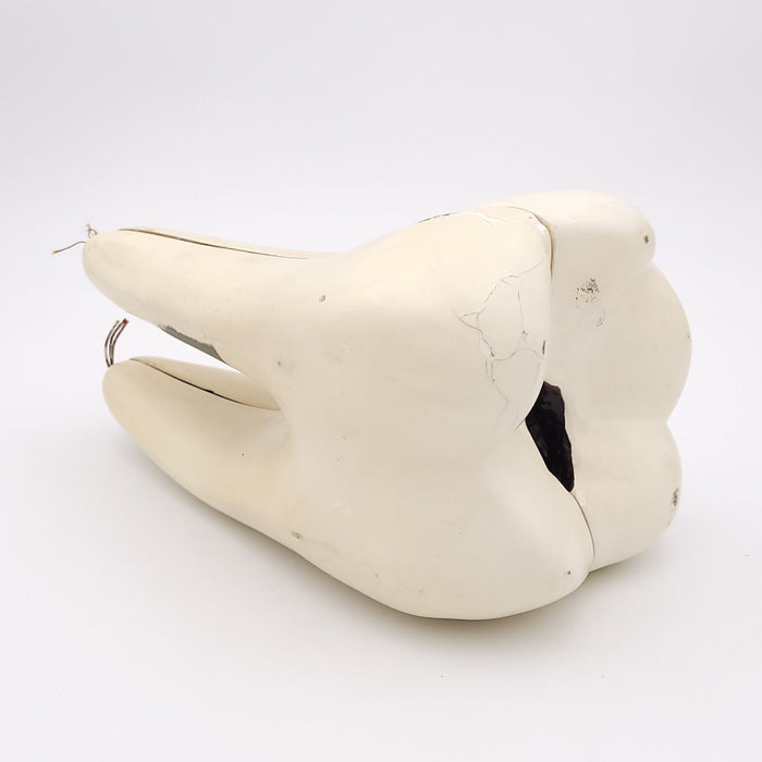 Early 20th Century Model of a Molar